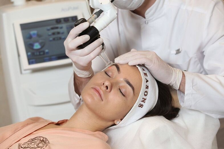 Smooth Laser fata rejuvenation